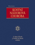 Kostní nádorová choroba