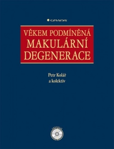 Věkem podmíněná makulární degenerace