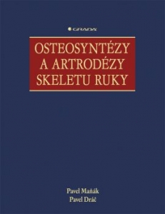 Osteosyntézy a artrodézy skeletu ruky