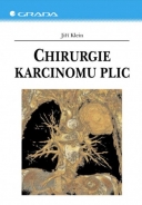 Chirurgie karcinomu plic - fotografie