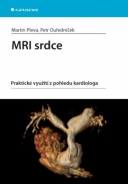 MRI srdce - fotografie